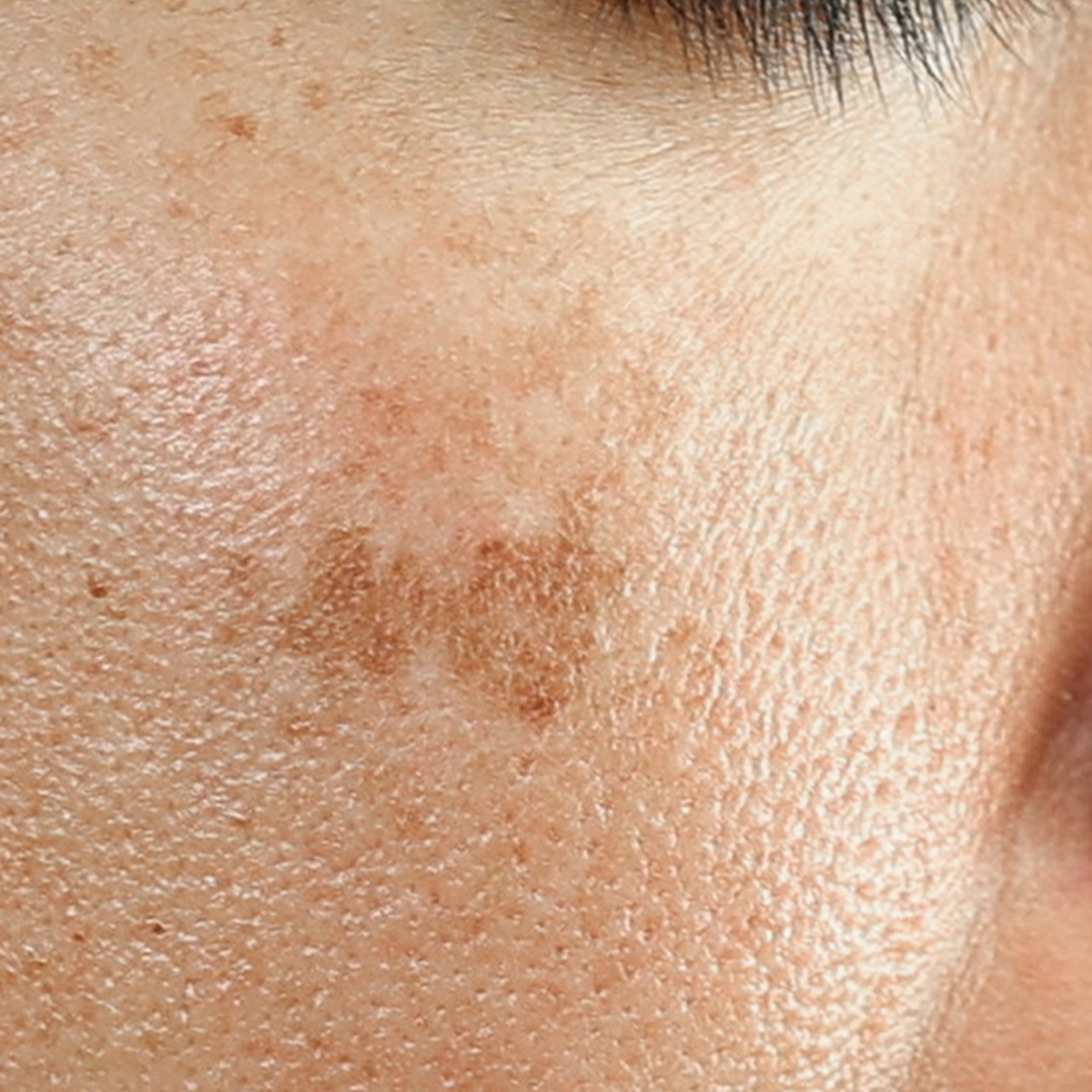 mirjam_bialik_skinnie_cosmetics_vorher-nachher_quadrat mirjam_bialik_skinnie_cosmetics_vorher-nachher_quadrat